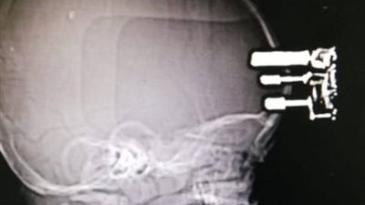 فريق طبي يخرج 