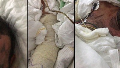 زوجة تحرق زوجها وهو نائم للانتقام منه بصيبا