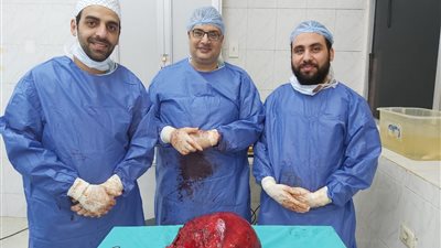استئصال ورم يزن 5 كيلو لأحد المرضى في طنطا