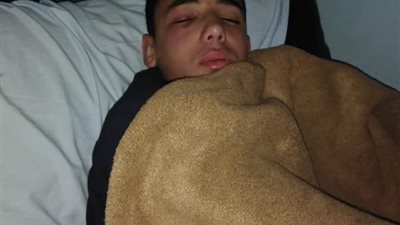 تفاصيل إصابة طالب بنزيف في العين على يد مدرس رياضيات بالدقهلية 