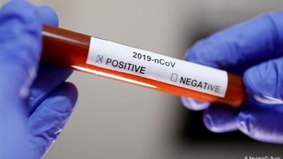 تايوان تسجل خمس حالات إصابة جديدة بفيروس كورونا  