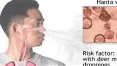 بعد انتشار كورونا.. فيروس 