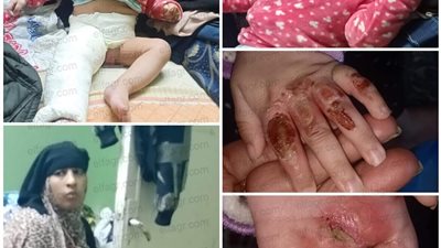 حرقتها وكسرت رجلها.. تفاصيل تعذيب الرضيعة 