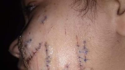 والدة الطفلة ضحية التعذيب على يد الأب تكشف مفاجآت