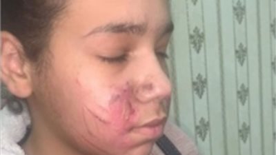 قانوني يوضح عقوبة الأب المتهم بتعذيب طفلته بأبو النمرس