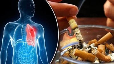 هل يحمى النيكوتين المدخنين من كورونا؟.. مركز الحساسية والمناعة يجيب