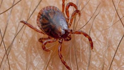أعراض تشبه كورونا.. أمراض تسببها حشرة القراد
