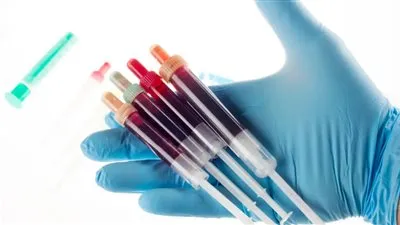 ما هي فصائل الدم الأكثرعُرضة للإصابة بكورونا؟