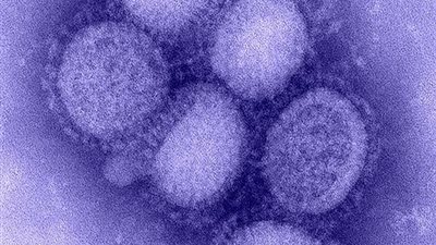 اكتشاف فيروس جديد في الصين.. وتحذير من 