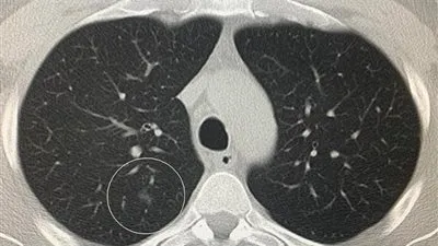 أيهما أدق لتشخيص كورونا المسحة أم الأشعة؟.. رئيس اللجنة العلمية يُجيب (فيديو)