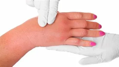 6 نصائح هامة لمعالجة احتباس الماء في الجسم