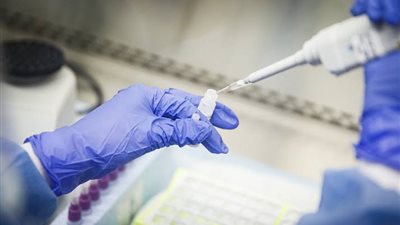 لم يمر بمرحلة التجارب الثالثة.. مفاجآت بشأن لقاح كورونا الروسي المنتظر