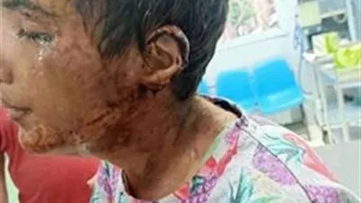 حرق وقص شعر وقطع أذن بـ