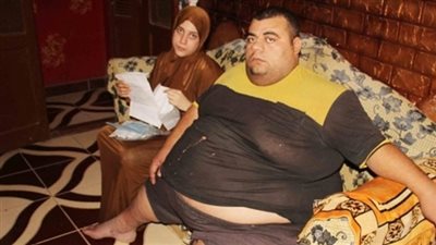 الصحة: فريق طبي لدراسة حالة مريض السمنة المفرطة قبل إجراء الجراحة