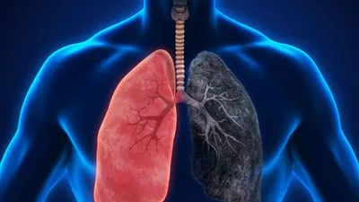 في اليوم العالمي للرئتين.. أعراض الإصابة بسرطان الرئة وطرق الوقاية منه