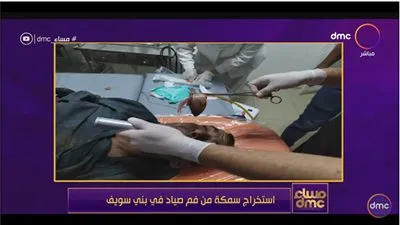 شاهد.. تفاصيل استخراج سمكة حية من فم صياد في بني سويف