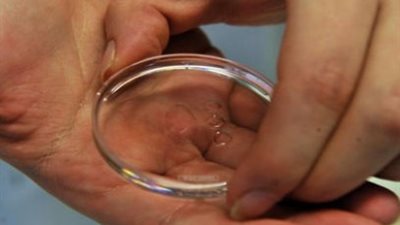 أستاذ نساء وتوليد يحذر من زيادة البويضات في هذه الحالة (فيديو)