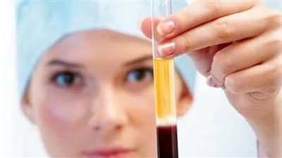 3 مراحل.. تفاصيل تصنيع مشتقات بلازما الدم في مصر 