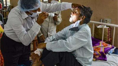 تعرف على أعراض عدوى الفطر الأصفر الجديد.. أبرزها الخمول وفقدان الشهية والوزن