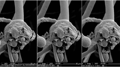 6 أسئلة مهمة حول الفطر الأسود.. هل انتشر في الدول العربية؟
