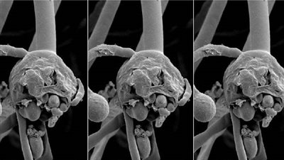 تعرف على طرق علاج الفطر الأسود ومخاطر التأخر في كشف الإصابة