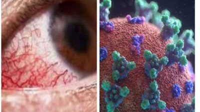 دراسة تكشف عن أمراض 