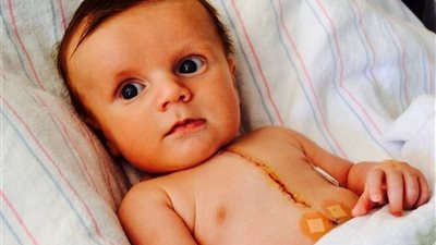 استشاري بقصر العيني.. يوضح صعوبات كشف ثقوب القلب لدى الجنين (فيديو)