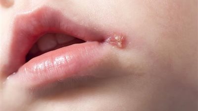 هاني الناظر يحذر بشدة من تقبيل الأطفال بالفم (فيديو)