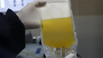 مدير المشروع القومي للتبرع بالبلازما: يهدف لعلاج الكثير من الأمراض