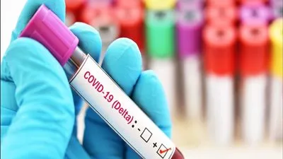 عضو فريق لقاح أكسفورد: سرعة تكاثر دلتا أكبر بـ1200 مرة من كورونا (فيديو)