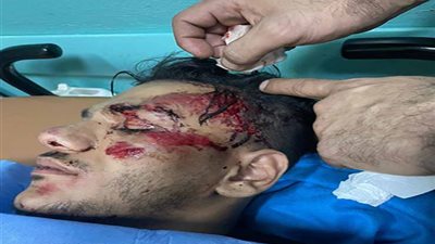 السادات أول المتضامنين مع حودة بندق بعد نجاته بأعجوبة من حادث سير