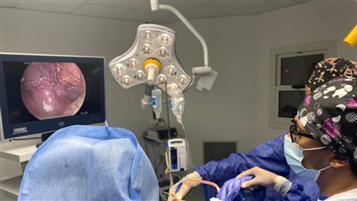 لأول مرة.. استئصال الغدة التيموسية لمريضة بمستشفى السلام ببورسعيد 