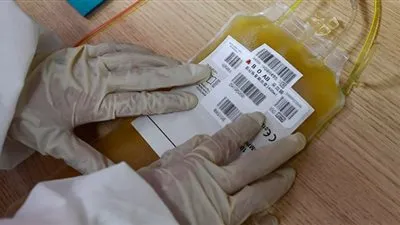 هذا ما يحدث للمريض حال عدم حصوله على مشتقات البلازما