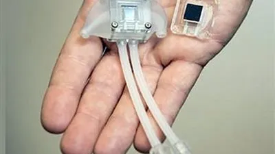 بعد اختراع باحثين بجامعة كاليفورنيا كلى صناعية.. هل وصل المصريين إليها أولاً؟