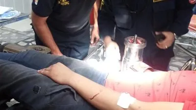 استغرقت 6 ساعات.. مستشفى جامعة طنطا تنقذ يد شاب من البتر