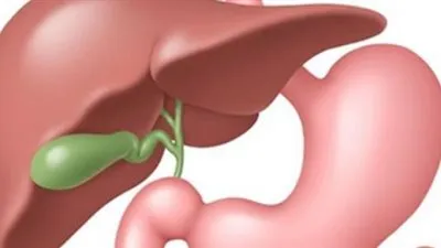 طبيب: المرارة السليمة لا يجب إزالتها تحت أي حال من الأحوال (فيديو)