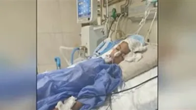 بعد دخول طفلة غيبوبة بسبب كيس دهني.. والدتها تكشف التفاصيل (فيديو)