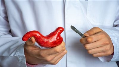 استشاري: تكميم المعدة تعالج السكر الخفيف فقط (فيديو) 