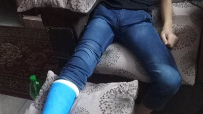 والد طالب يستغيث بوزير التعليم بعد كسر رجل نجله داخل مدرسة بطرة