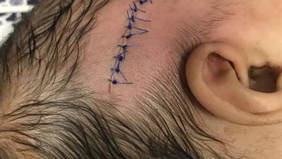 شرخ بالمخ ونزيف.. أم رضيعة المنوفية: 