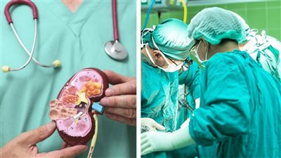 أزهري عن زرع كلى خنزير: جائز تحت مبدأ لا حرام مع ضرورة 