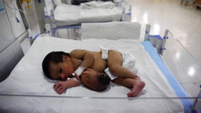 آيات قرآنية وطفل بذيل وكرة.. أغرب المواليد حول العالم