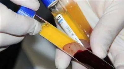 استشاري كبد: نستهدف تصدير مشتقات البلازما للدول الإفريقية (فيديو)