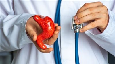 طبيب: عملية التكميم تستمر العمر كله في هذه الحالة (فيديو)