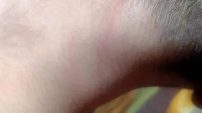 طالب يتهم والدته وزوجها العرفي بالاعتداء عليه بالضرب ببنها