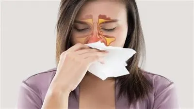 أستاذ بطب القصر العيني يحذر من إهمال علاج الجيوب الأنفية (فيديو)