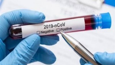 الجزائر تسجل 610 إصابات جديدة بكوفيد 19