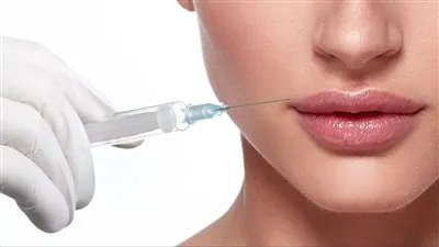 أخصائية تجميل تكشف أفضل أنواع الفيلر للشفايف وحجمها (فيديو)