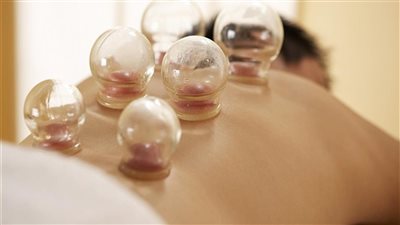 أستاذ جراحة: الحجامة انتشرت في عصور ما قبل العلم الحديث