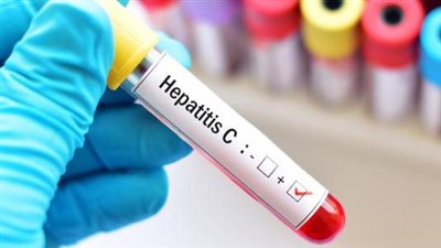 استشاري عظام: إعلان مصر خالية من فيروس سي عمل غير مسبوق (فيديو)